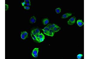 Immunofluorescent analysis of MCF-7 cells using ABIN7173183 at dilution of 1:100 and Alexa Fluor 488-congugated AffiniPure Goat Anti-Rabbit IgG(H+L) (TMEM256 anticorps  (AA 30-63))