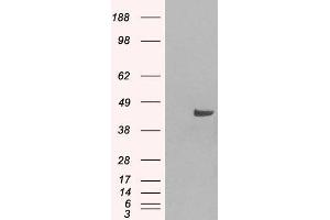 Western Blotting (WB) image for anti-Sorting Nexin 16 (SNX16) antibody (ABIN5877322) (SNX16 anticorps)