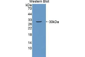 Detection of Recombinant PLXNB1, Mouse using Polyclonal Antibody to Plexin B1 (PLXNB1) (PLXNB1 anticorps  (AA 1598-1849))