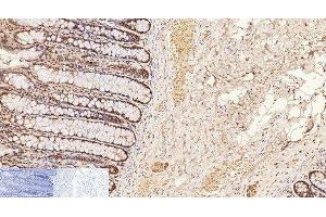 Immunohistochemistry of paraffin-embedded Human colon tissue using CD2 Monoclonal Antibody at dilution of 1:200. (CD2 anticorps)