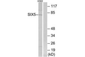 Western Blotting (WB) image for anti-Homeobox protein SIX5 (SIX5) (AA 201-250) antibody (ABIN2890384) (Six5 anticorps  (AA 201-250))