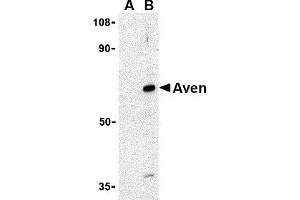 Western Blotting (WB) image for anti-Apoptosis, Caspase Activation Inhibitor (AVEN) (N-Term) antibody (ABIN1031252) (AVEN anticorps  (N-Term))