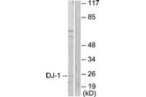 Western blot analysis of extracts from HuvEc cells, using DJ-1 Antibody. (PARK7/DJ1 anticorps  (AA 21-70))