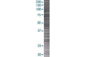 INPP5E transfected lysate. (INPP5E 293T Cell Transient Overexpression Lysate(Denatured))