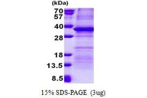 SDS-PAGE (SDS) image for Pregnancy Specific beta-1-Glycoprotein 5 (PSG5) (AA 35-335) protein (His tag) (ABIN5853142) (PSG5 Protein (AA 35-335) (His tag))