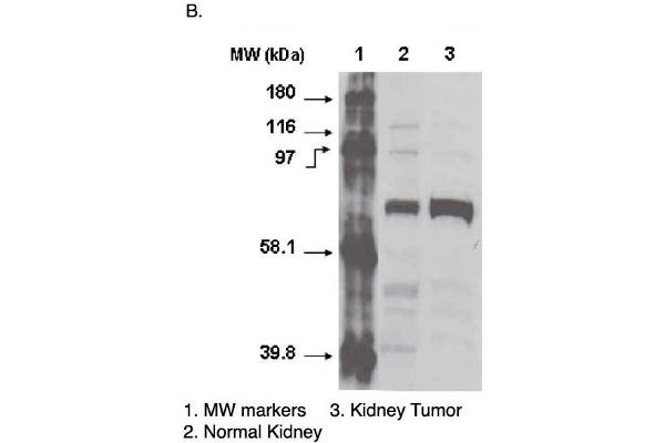 CYP4F11 anticorps  (C-Term)