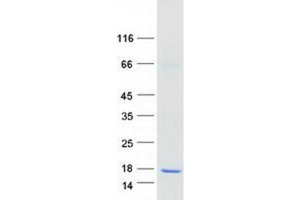 ATP6V1G2 Protein (Transcript Variant 2) (Myc-DYKDDDDK Tag)