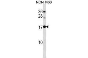 RPL12 Antibody (Center) western blot analysis in NCI-H460 cell line lysates (35µg/lane). (RPL12 anticorps  (Middle Region))