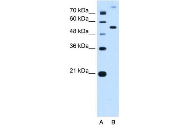 PPAT anticorps  (N-Term)