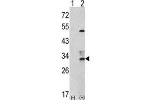 Western Blotting (WB) image for anti-Capping Protein (Actin Filament) Muscle Z-Line, beta (CAPZB) antibody (ABIN3001693) (CAPZB anticorps)