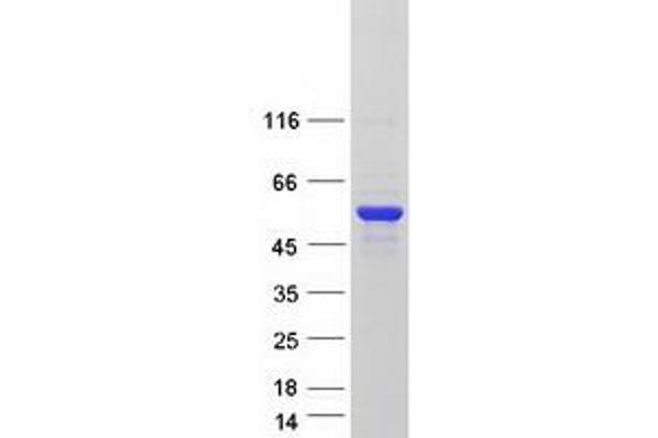 CAZIP Protein (Transcript Variant 2) (Myc-DYKDDDDK Tag)