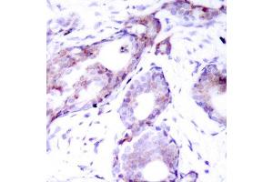 Immunohistochemistry (IHC) image for anti-Myc Proto-Oncogene protein (MYC) (pSer373) antibody (ABIN1870452) (c-MYC anticorps  (pSer373))