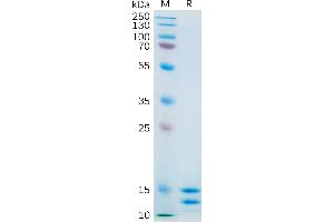 Human IL2 Protein, His Tag on SDS-PAGE under reducing condition. (IL-2 Protein (AA 21-153) (His tag))
