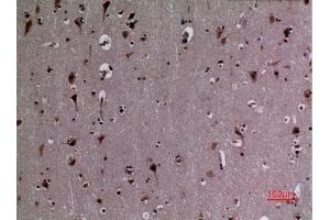 Immunohistochemical analysis of paraffin-embedded human-brain, antibody was diluted at 1:100. (HSP90 anticorps  (acLys284, acLys292))