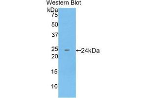 Western Blotting (WB) image for anti-Keratin 18 (KRT18) (AA 238-396) antibody (ABIN1859576) (Cytokeratin 18 anticorps  (AA 238-396))