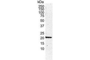 Western Blotting (WB) image for anti-HRas proto-oncogene, GTPase (HRAS) antibody (ABIN2473919) (HRAS anticorps)