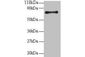 Western blot All lanes: RPS18 antibody at 2 μg/mL + 293T whole cell lysate Secondary Goat polyclonal to rabbit IgG at 1/15000 dilution Predicted band size: 18 kDa Observed band size: 75 kDa (RPS18 anticorps  (AA 2-152))