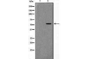 Western blot analysis on 293 cell lysate using AKT1 Antibody，The lane on the left is treated with the antigen-specific peptide. (AKT1 anticorps  (C-Term))
