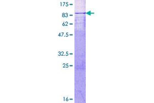 MTA3 Protein (AA 1-515) (GST tag)