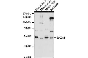 Western blot analysis of extracts of various cell lines, using SLC2 antibody (ABIN7270412) at 1:1000 dilution. (SLC2A8 anticorps  (AA 200-260))