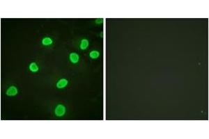 Immunofluorescence analysis of HeLa cells, using Histone H4 (Acetyl-Lys5) Antibody. (Histone H4 anticorps  (acLys5))