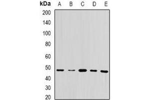 Western blot analysis of UQCRC2 expression in MCF7 (A), HepG2 (B), mouse brain (C), mouse liver (D), rat testis (E) whole cell lysates. (UQCRC2 anticorps)