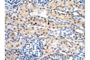 SULF2 antibody was used for immunohistochemistry at a concentration of 4-8 ug/ml. (SULF2 anticorps  (C-Term))