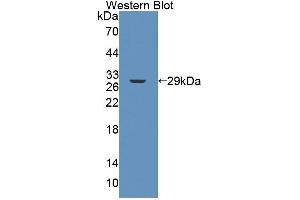 Western blot analysis of the recombinant protein. (FPGS anticorps  (AA 210-439))