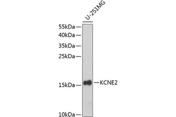 KCNE2 anticorps  (AA 1-100)