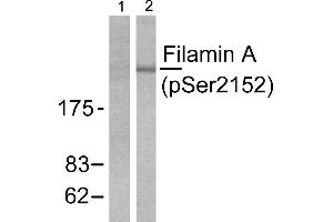 Western blot analysis of extracts from 293 cells treated with EGF (200ng/ml, 5mins), using Filamin A (phospho-Ser2152) antibody. (Filamin A anticorps  (pSer2152))