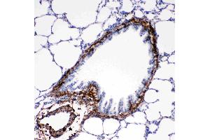 Immunohistochemistry (IHC) image for anti-Collagen, Type I, alpha 1 (COL1A1) (AA 1192-1207), (C-Term) antibody (ABIN5518708)