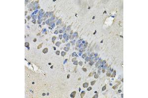 Immunohistochemistry of paraffin-embedded rat brain using MYH1 Antibody (ABIN2563998) at dilution of 1:100 (40x lens). (MYH1 anticorps)