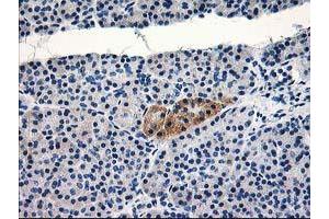 Immunohistochemistry (IHC) image for anti-TBC1 Domain Family, Member 21 (TBC1D21) antibody (ABIN1501315) (TBC1D21 anticorps)