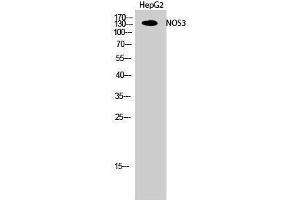 Western Blotting (WB) image for anti-Nitric Oxide Synthase 3 (Endothelial Cell) (NOS3) (Thr180) antibody (ABIN3180214) (ENOS anticorps  (Thr180))