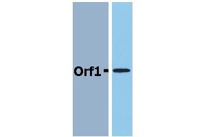 Western Blotting analysis (reducing conditions) of recombinant protein Orf1 in cell lysate of Orf1-transfected E. (Neisseria Meningitidis Antigen Orf1 anticorps)