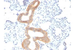 Formalin-fixed, paraffin-embedded human Melanoma stained with CD86 Mouse Monoclonal Antibody (SPM600). (CD86 anticorps)