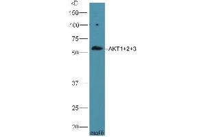 HepG2 lysate probed with Rabbit Anti-AKT1+2+3 Polyclonal Antibody (ABIN1387781) at 1:300 overnight in 4 °C. (AKT 1/2/3 anticorps  (AA 401-480))