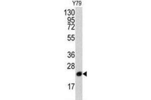 Western Blotting (WB) image for anti-Phosphatidylethanolamine Binding Protein 1 (PEBP1) antibody (ABIN3003677) (PEBP1 anticorps)