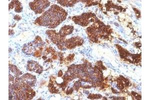 Formalin-fixed, paraffin-embedded human parathyroid stained with PTH antibody (PTH/1175). (PTH anticorps  (AA 32-115))