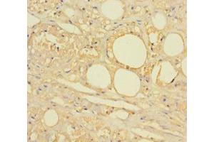 Immunohistochemistry of paraffin-embedded human skin tissue using HTR2A Antibody at dilution 1:100. (HTR2A anticorps  (AA 385-471))