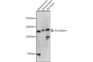Western blot analysis of extracts of various cell lines, using N-Cadherin antibody (ABIN1684127, ABIN1514384, ABIN5663657 and ABIN6213846) at 1:500 dilution. (N-Cadherin anticorps  (AA 450-550))