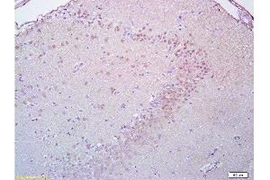 Formalin-fixed and paraffin embedded rat brain tissue labeled with Anti-Brdu Polyclonal Antibody, Unconjugated  at 1:200, followed by conjugation to the secondary antibody and DAB staining (BrdU anticorps)