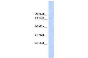 PARP6 antibody used at 1. (PARP6 anticorps  (N-Term))