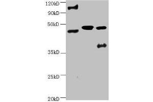 All lanes:Mouse anti-human ENO2 monoclonal antibody at 1 μg/mL Lane 1:Hela cell lysate Lane 2:Recombinant Human Gamma-enolase(ENO2) at 10 μg Lane 3:U251 cell lysate Secondary Goat polyclonal to Mouse IgG at 1/3000 dilution Predicted band size : 43,48 kD Observed band size: 48 kD Additional bands at : 100 kDa. (ENO2/NSE anticorps)