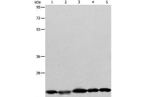 Western Blot analysis of Human brain malignant glioma tissue, MCF7, Raji, Lovo and 293T cell using BAX Polyclonal Antibody at dilution of 1:426 (BAX anticorps)