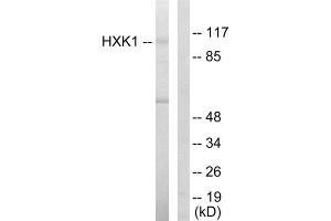 Western blot analysis of extracts from HeLa cells, using HXK1 antibody. (Hexokinase 1 anticorps  (N-Term))