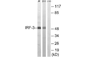 Western blot analysis of extracts from Jurkat cells and 293 cells, using IRF-3 (Ab-386) antibody. (IRF3 anticorps  (Ser386))