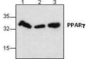Image no. 1 for anti-Peroxisome Proliferator-Activated Receptor gamma (PPARG) antibody (ABIN191899) (PPARG anticorps)