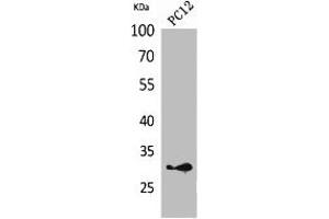 Western Blot analysis of PC12 cells using HLA-DQB1/2 Polyclonal Antibody. (HLA-DQB2 anticorps  (Internal Region))