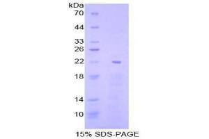 SDS-PAGE (SDS) image for Early Growth Response 1 (EGR1) (AA 282-433) protein (His tag) (ABIN2124682) (EGR1 Protein (AA 282-433) (His tag))